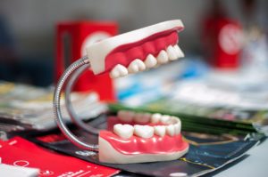 model of a jaw set at a orthodontists dental practice