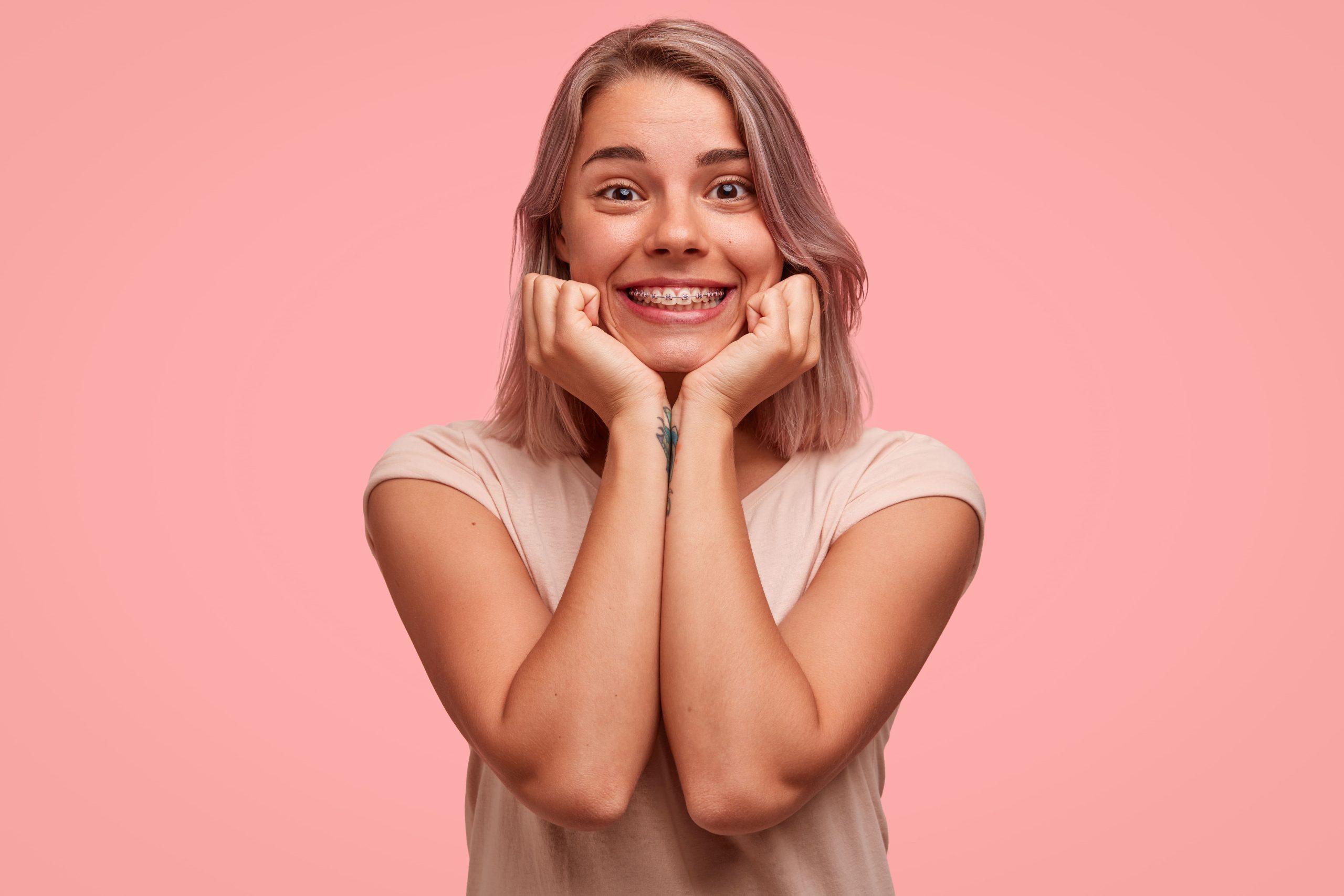 -young-blonde-woman-with-braces woman with braces