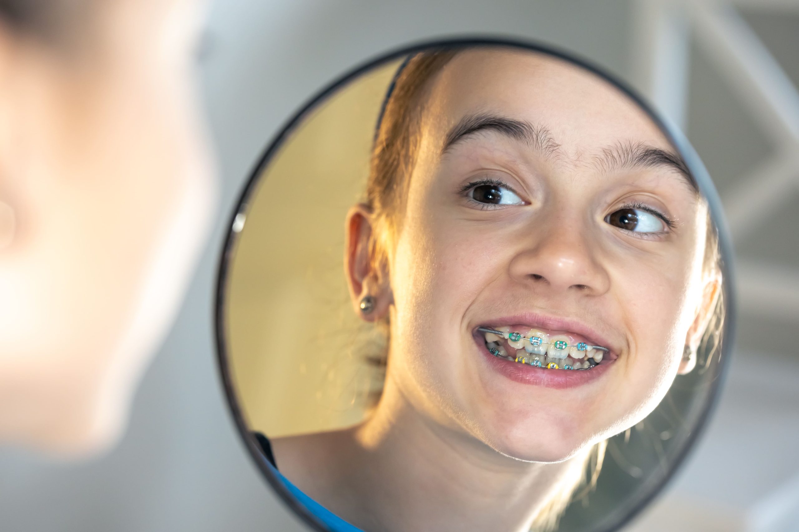 Metalic braces A Girl with braces