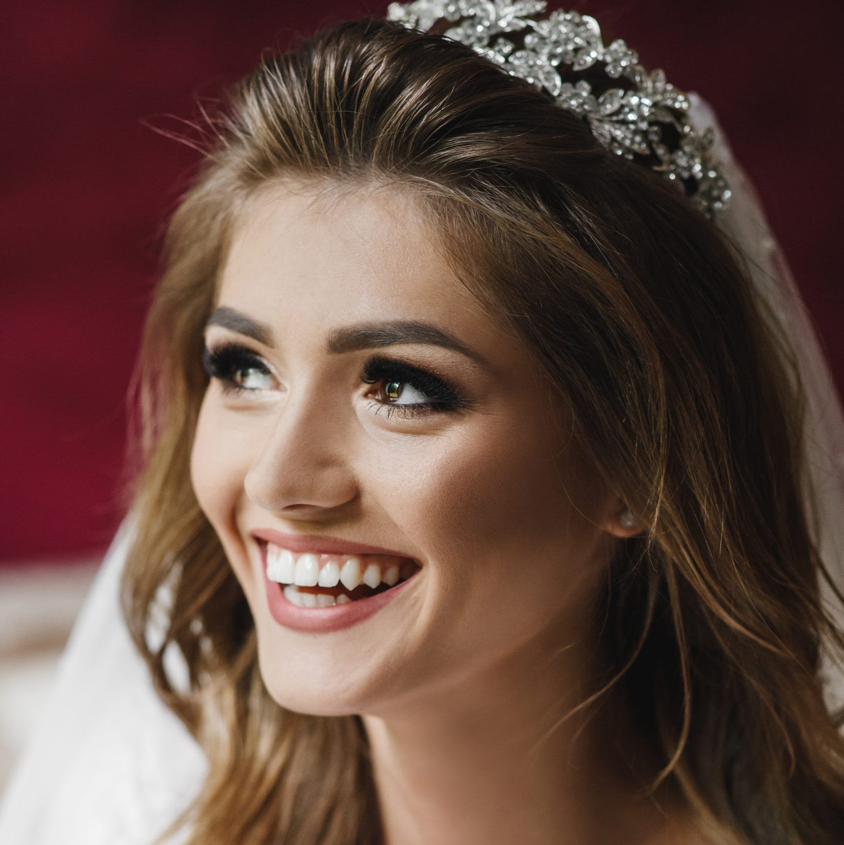 Teeth makeover for wedding