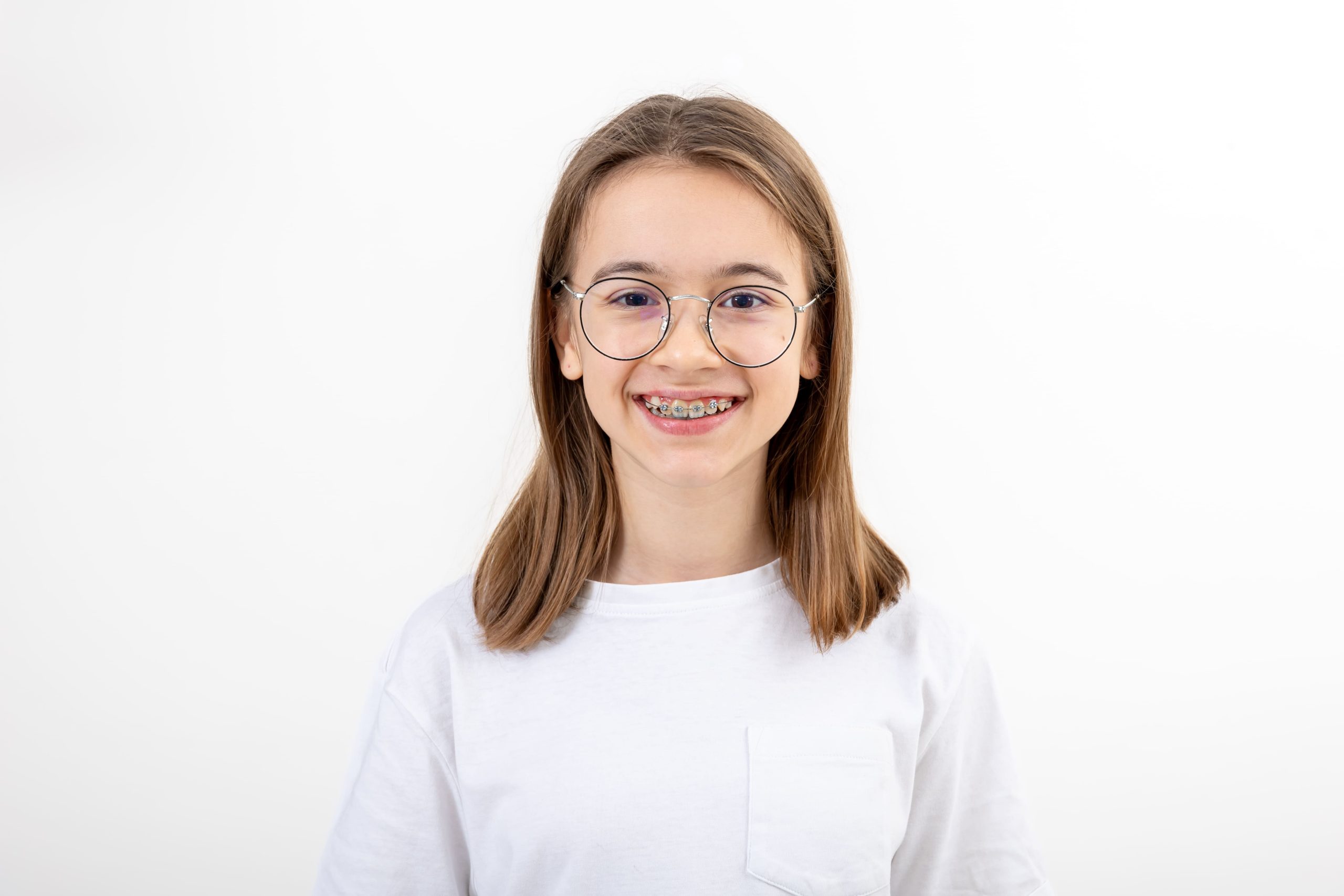 teenage-girl-wearing-glasses-braces-her-teeth (1) what age your child should start orthodontic treatment